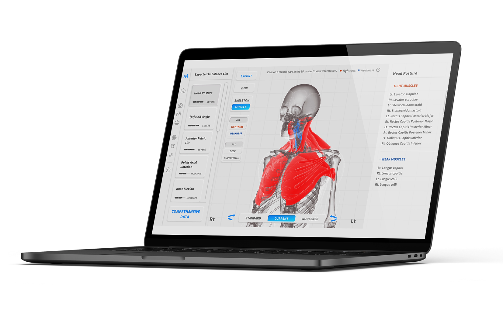 AI Posture Analysis Results - Chicago