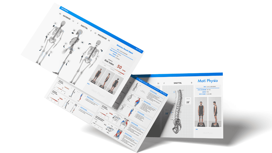 AI Posture Analysis
