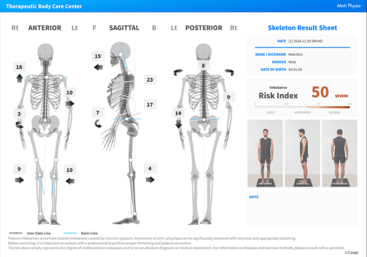 AI Posture Analysis Results