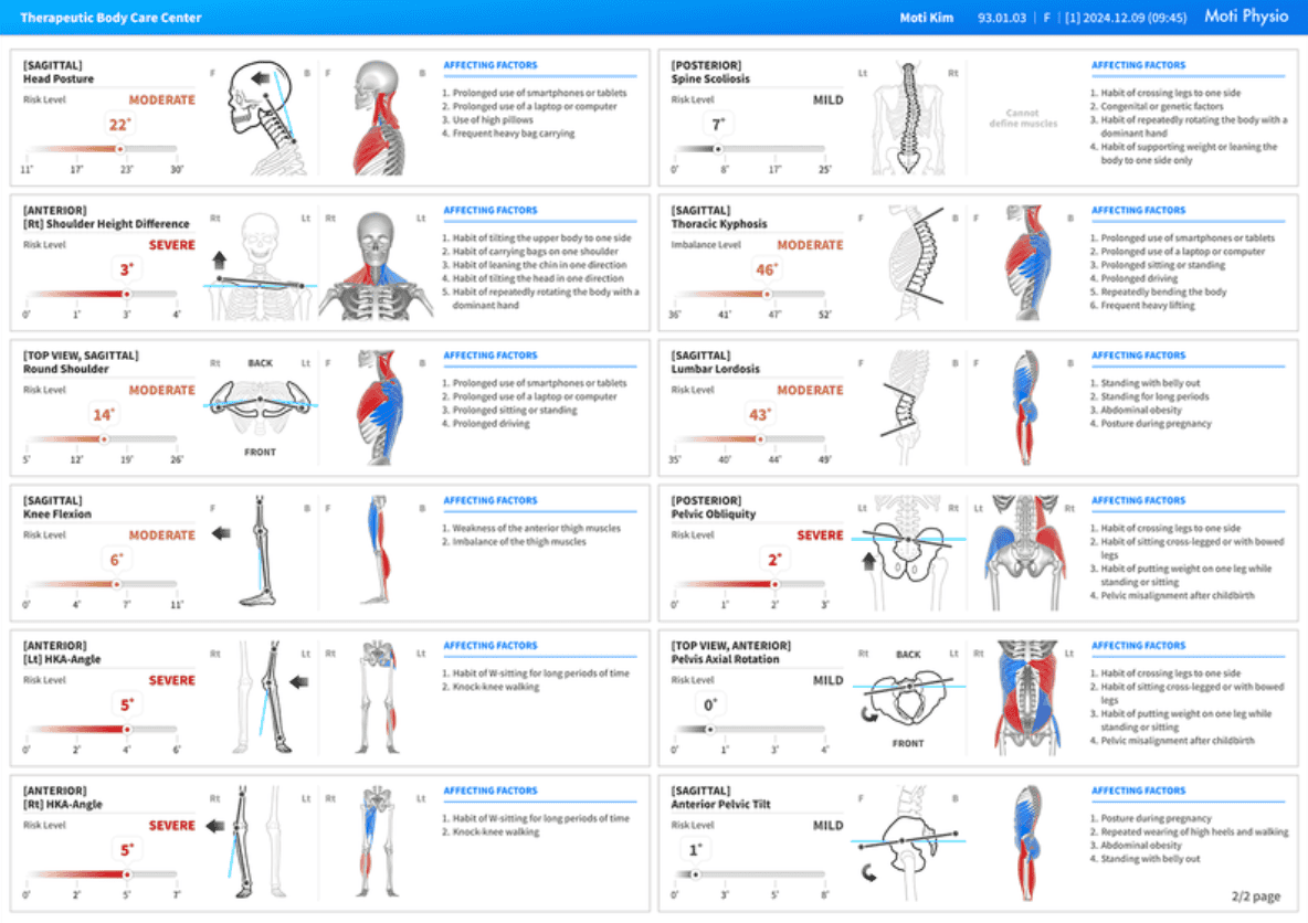 AI Posture Analysis Reporting
